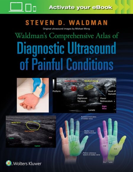 Waldman's Comprehensive Atlas of Diagnostic Ultrasound of Painful Conditions 2016
