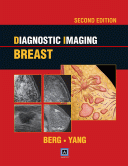 Diagnostic Imaging: Breast, 2/E