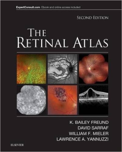 The Retinal Atlas, 2/E 2017