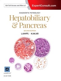Diagnostic Pathology: Hepatobiliary and Pancreas, 2nd Edition 2017