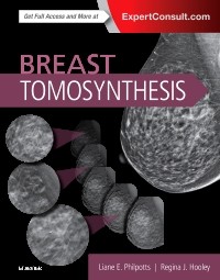 Breast Tomosynthesis 2017