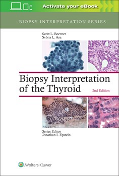 Biopsy Interpretation of the Thyroid 2/E 2017