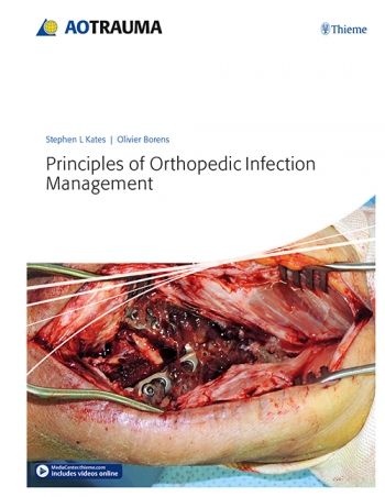 Principles of Orthopedic Infection Management 2017