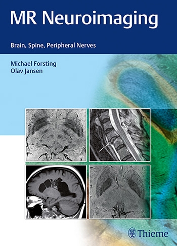 MR Neuroimaging  Brain, Spine, and Peripheral Nerves