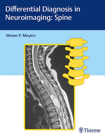 Differential Diagnosis in Neuroimaging: Spine 2017