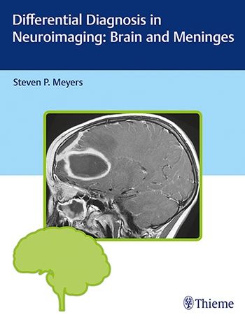 Differential Diagnosis in Neuroimaging: Brain and Meninges 2017