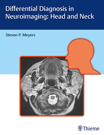 Differential Diagnosis in Neuroimaging: Head and Neck 2017