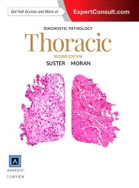 Diagnostic Pathology: Thoracic, 2nd Edition 2017