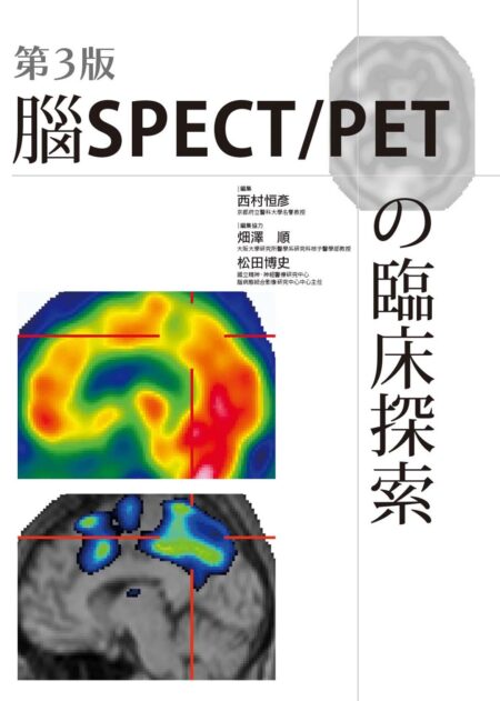 腦SPECT/PETの臨床探索(第3版)