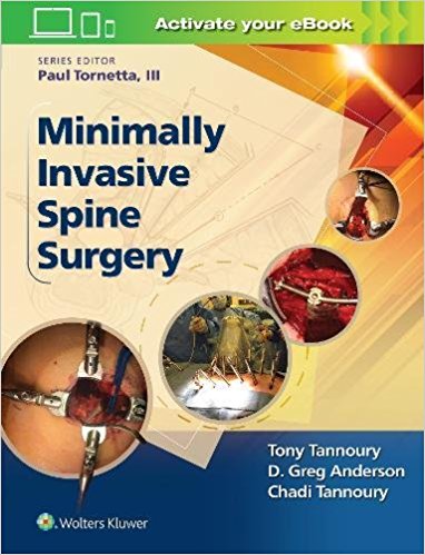 Minimally Invasive Spine Surgery 2017