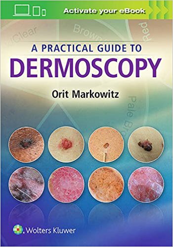 A Practical Guide to Dermoscopy 2018