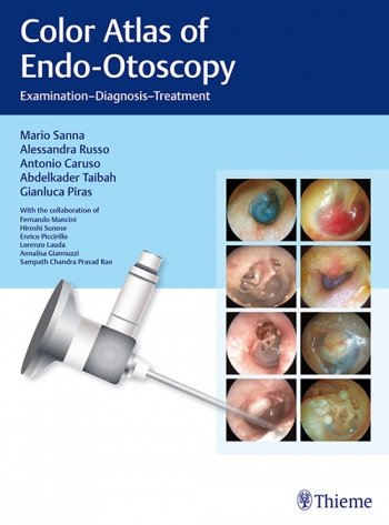 Color Atlas of Endo-Otoscopy: Examination-Diagnosis-Treatment  2017