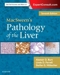 MacSween's Pathology of the Liver, 7/E 2018