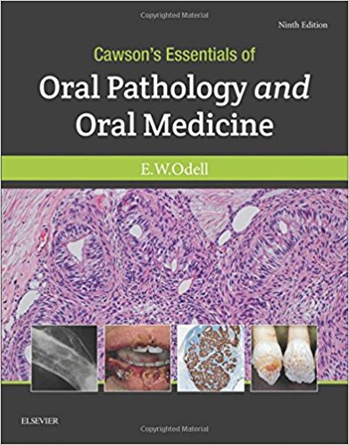 Cawson's Essentials of Oral Pathology and Oral Medicine, 9e