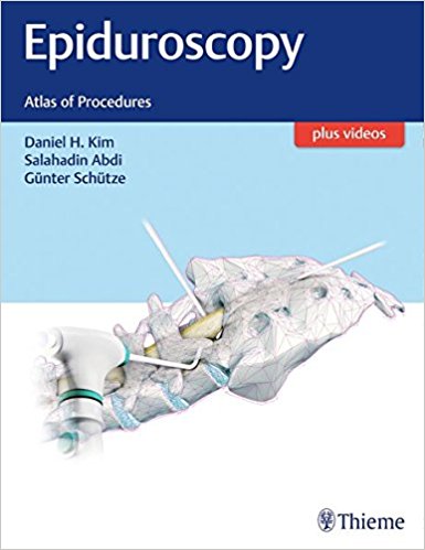 Epiduroscopy: Atlas of Procedures 2017
