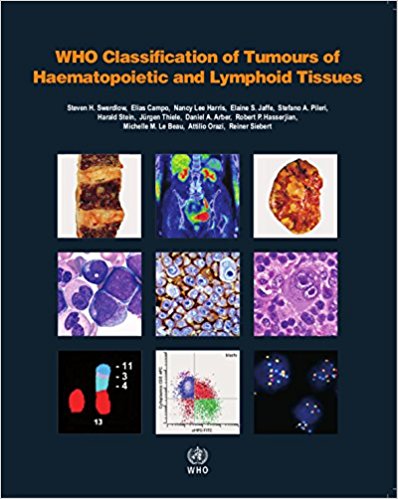 WHO Classification of Tumours of Haematopoietic and Lymphoid Tissues Revised Edition 2017