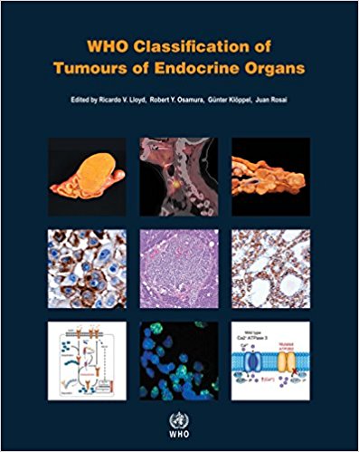 WHO Classification of Tumours of Endocrine Organs  4th Edition 2017(已絕版，請勿下訂)