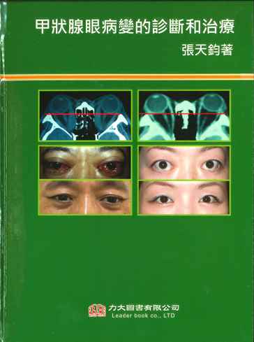 甲狀腺眼病變的診斷和治療