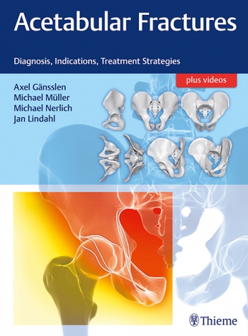 Acetabular Fractures :Diagnosis, Indications, Treatment Strategies 2018