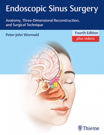 Endoscopic Sinus Surgery: Anatomy, Three-Dimensional Reconstruction, and Surgical Technique 4/E 2018
