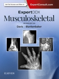 ExpertDDx: Musculoskeletal, 2nd Edition 2018