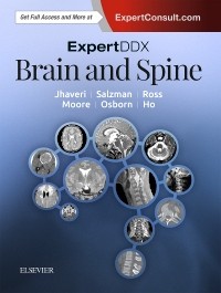 ExpertDDx: Brain and Spine, 2nd Edition 2018
