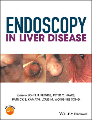 Endoscopy in Liver Disease 2018