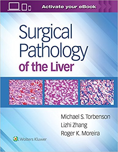 Surgical Pathology of the Liver 2018