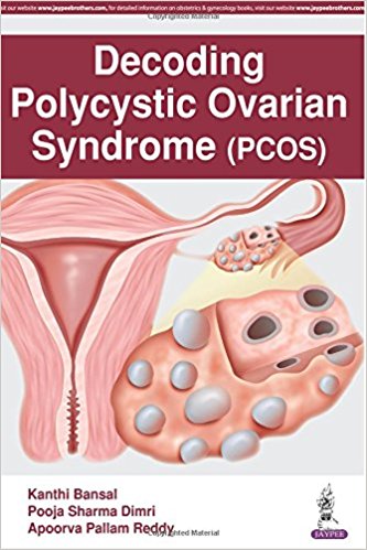 Decoding Polycystic Ovarian Syndrome