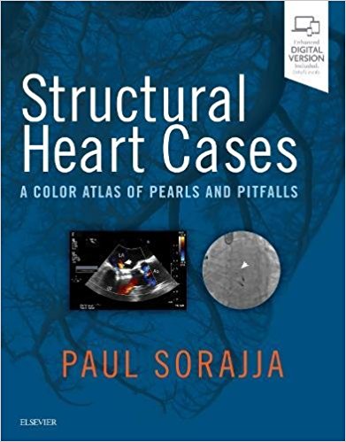 Structural Heart Cases: A Color Atlas of Pearls and Pitfalls 2018