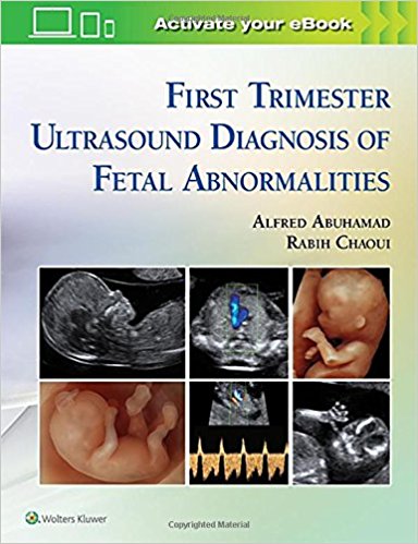 First Trimester Ultrasound Diagnosis of Fetal Abnormalities 2018