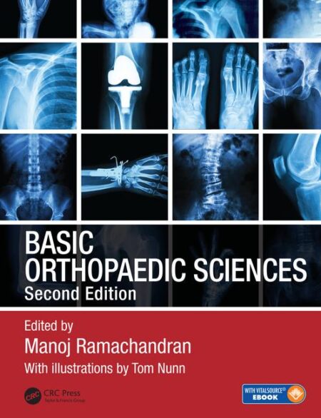 Basic Orthopaedic Sciences,  2nd Edition 2018