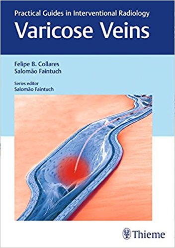 Varicose Veins: Practical Guides in Interventional Radiology 2018
