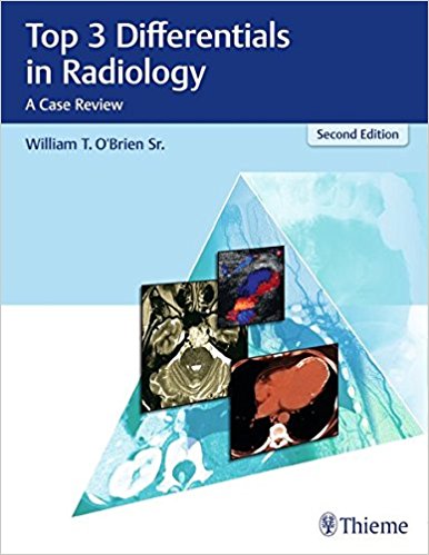 Top 3 Differentials in Radiology: A Case Review 2/E