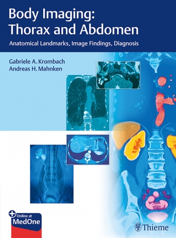 Body Imaging: Thorax and Abdomen: Anatomical Landmarks, Image Findings, Diagnosis 2018