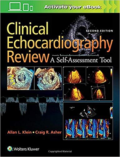 Clinical Echocardiography Review Second Edition 2017