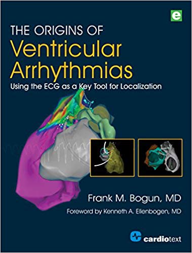 The Origins of Ventricular Arrhythmias: Using the ECG As a Key Tool for Localization
