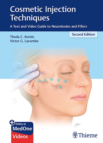 Cosmetic Injection Techniques: A Text and Video Guide to Neurotoxins and Fillers 2/E 2019