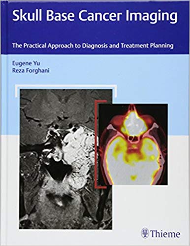 Skull Base Cancer Imaging: The Practical Approach to Diagnosis and Treatment Planning