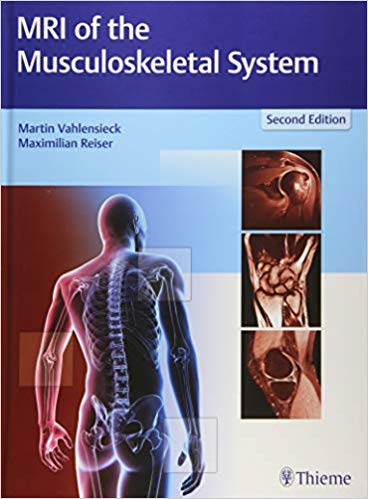 MRI of the Musculoskeletal System 2/E