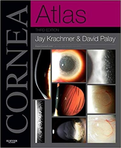 Cornea Atlas: Expert Consult - Online and Print 3rd Edition