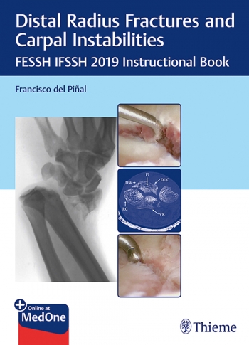Distal Radius Fractures and Carpal Instabilities: FESSH IFSSH 2019 Instructional Book 2019