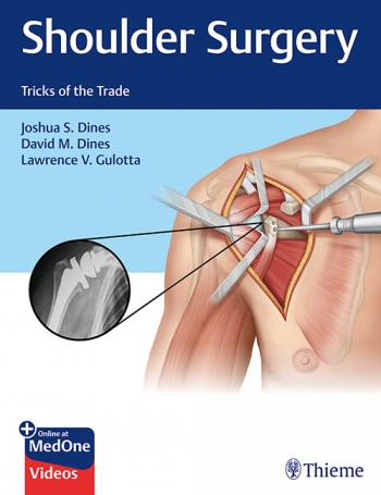 Shoulder Surgery: Tricks of the Trade 2019