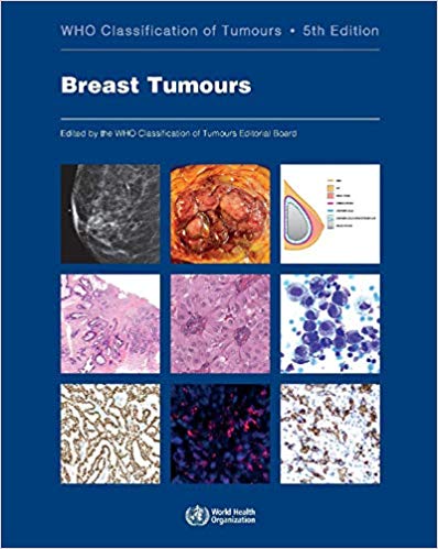 WHO Classification of Breast Tumours. Fifth Edition 2019
