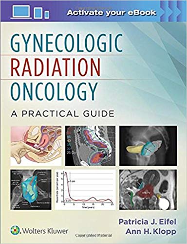 Gynecologic Radiation Oncology: A Practical Guide