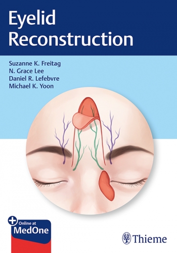 Eyelid Reconstruction 2020