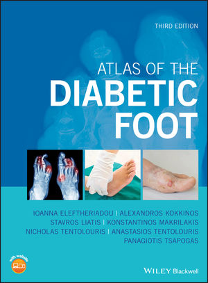 Atlas of the Diabetic Foot 3rd Edition 2019