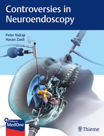 Controversies in Neuroendoscopy 2020
