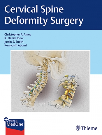 Cervical Spine Deformity Surgery 2020