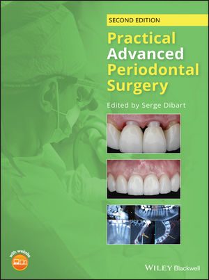 Practical Advanced Periodontal Surgery 2/E 2020